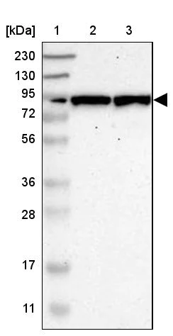 Western blot - Anti-GALNT8 antibody (AB121374)