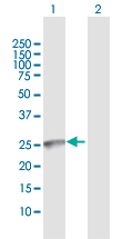 Western blot - Anti-GALNT9 antibody (AB172528)