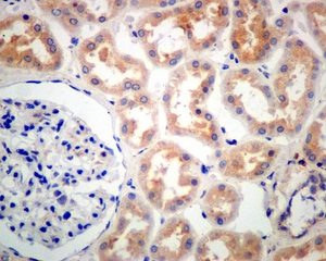 Immunohistochemistry (Formalin/PFA-fixed paraffin-embedded sections) - Anti-GALNTL2 antibody [EPR11580] (AB174275), expandable thumbnail