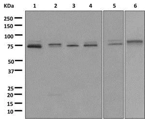 Western blot - Anti-GALNTL2 antibody [EPR11580] (AB174275)