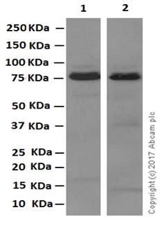 Western blot - Anti-GALNTL2 antibody [EPR11580] (AB174275), expandable thumbnail