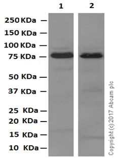 Western blot - Anti-GALNTL2 antibody [EPR11580] (AB174275)