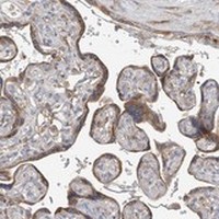 Immunohistochemistry (Formalin/PFA-fixed paraffin-embedded sections) - Anti-GALNTL6 antibody (AB122149), expandable thumbnail