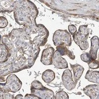 Immunohistochemistry (Formalin/PFA-fixed paraffin-embedded sections) - Anti-GALNTL6 antibody (AB122149)