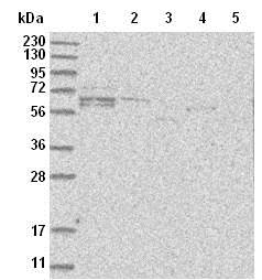 Western blot - Anti-GALNTL6 antibody (AB122149), expandable thumbnail