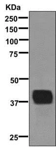 Western blot - Anti-GALP antibody [EPR10528] - BSA and Azide free (AB249594)