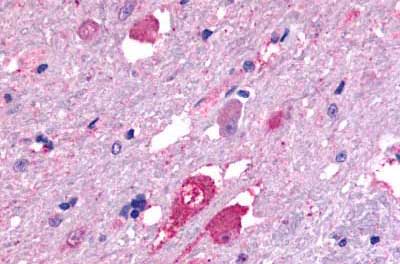 Immunohistochemistry (Formalin/PFA-fixed paraffin-embedded sections) - Anti-GALR2 antibody (AB188753), expandable thumbnail