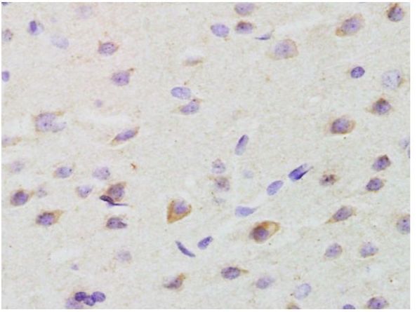 Immunohistochemistry (Formalin/PFA-fixed paraffin-embedded sections) - Anti-GALR2 antibody (AB203072)