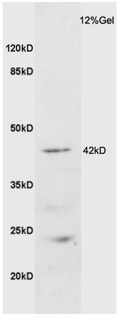Western blot - Anti-GALR2 antibody (AB203072)