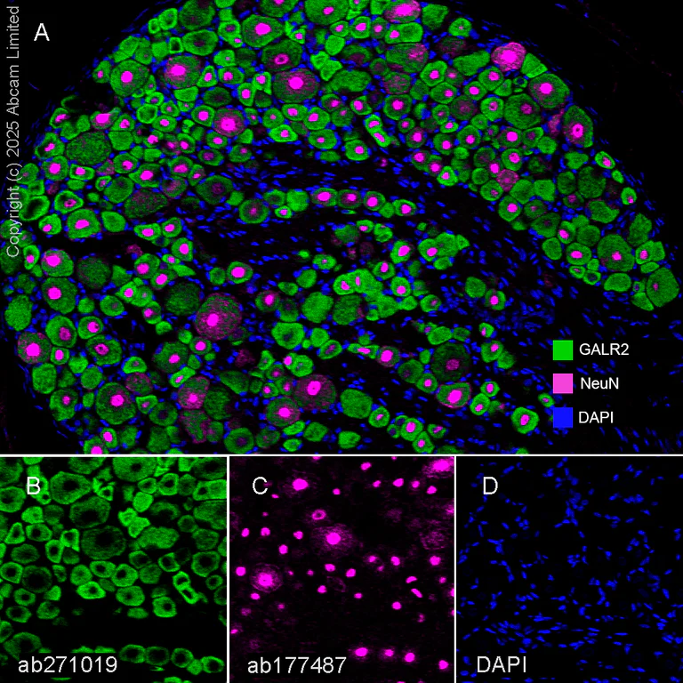 Multiplex immunohistochemistry - Anti-GALR2 antibody [EPR24328A-120] (AB271019)