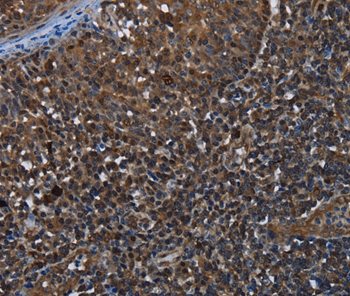Immunohistochemistry (Formalin/PFA-fixed paraffin-embedded sections) - Anti-GALT antibody (AB198044)