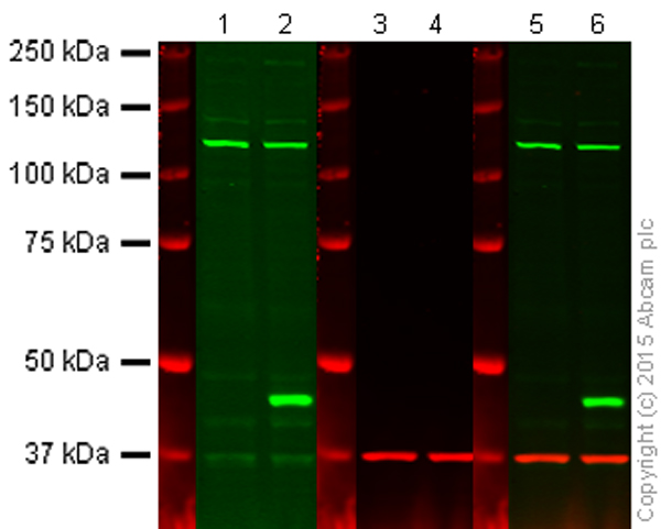Western blot - Anti-GALT antibody [EPR12555] (AB178406), expandable thumbnail