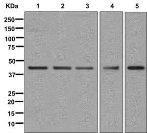 Western blot - Anti-GALT antibody [EPR12555] (AB178406), expandable thumbnail