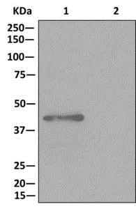 Immunoprecipitation - Anti-GALT antibody [EPR12555] - BSA and Azide free (AB240206)