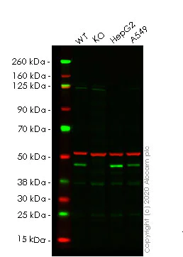 Western blot - Anti-GALT antibody [EPR12555] - BSA and Azide free (AB240206)