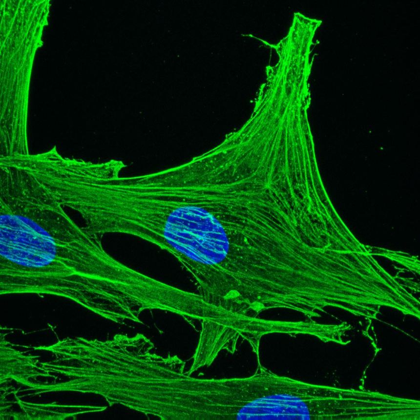 Immunocytochemistry/ Immunofluorescence - Anti-gamma Actin antibody [2A3] (AB123034), expandable thumbnail