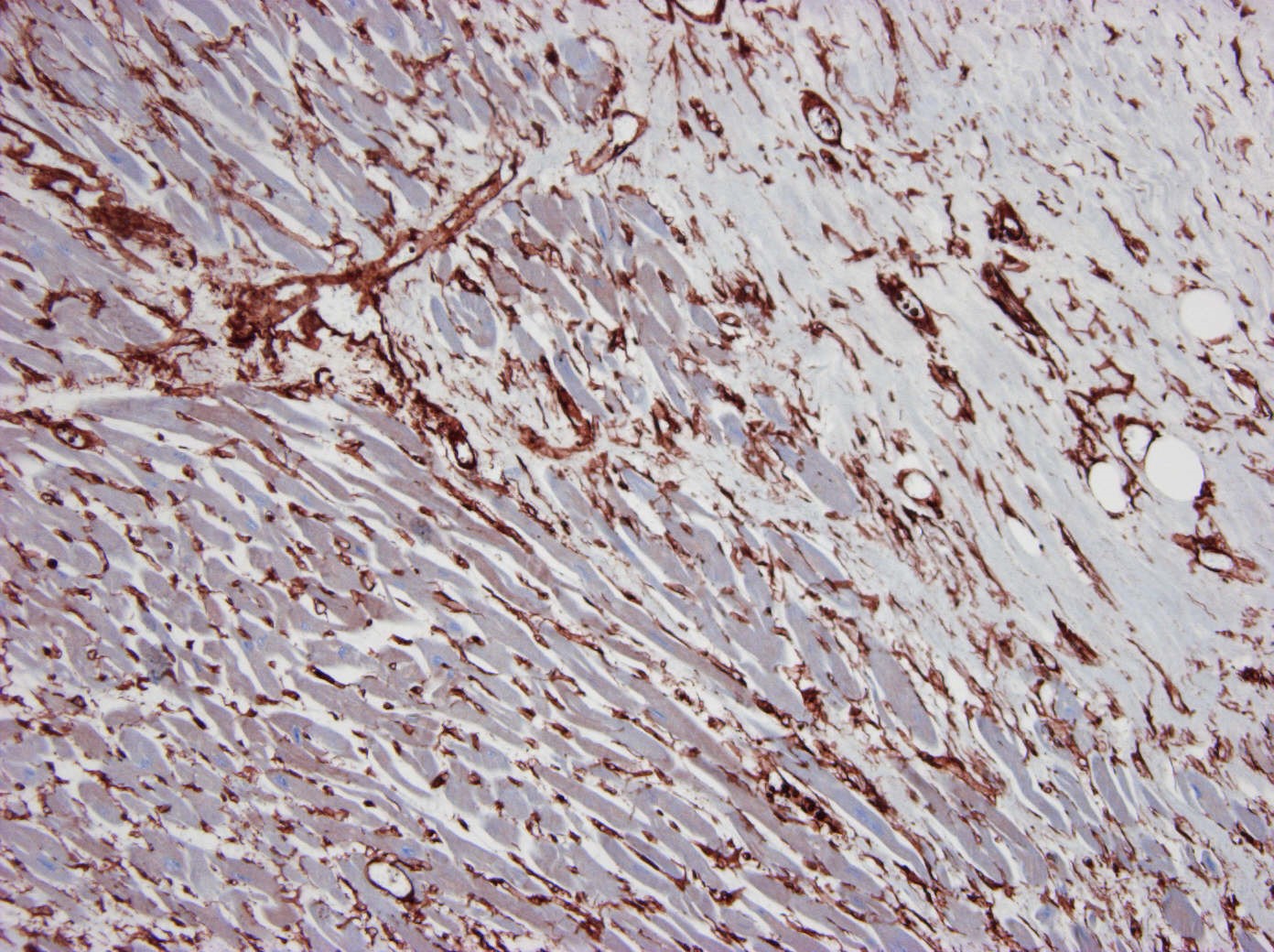 Immunohistochemistry (Formalin/PFA-fixed paraffin-embedded sections) - Anti-gamma Actin antibody [2A3] (AB123034), expandable thumbnail