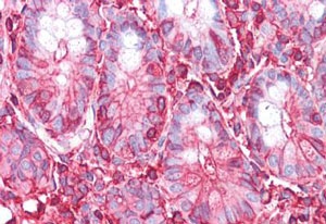 Immunohistochemistry (Formalin/PFA-fixed paraffin-embedded sections) - Anti-gamma Actin antibody [2A3] (AB123034), expandable thumbnail