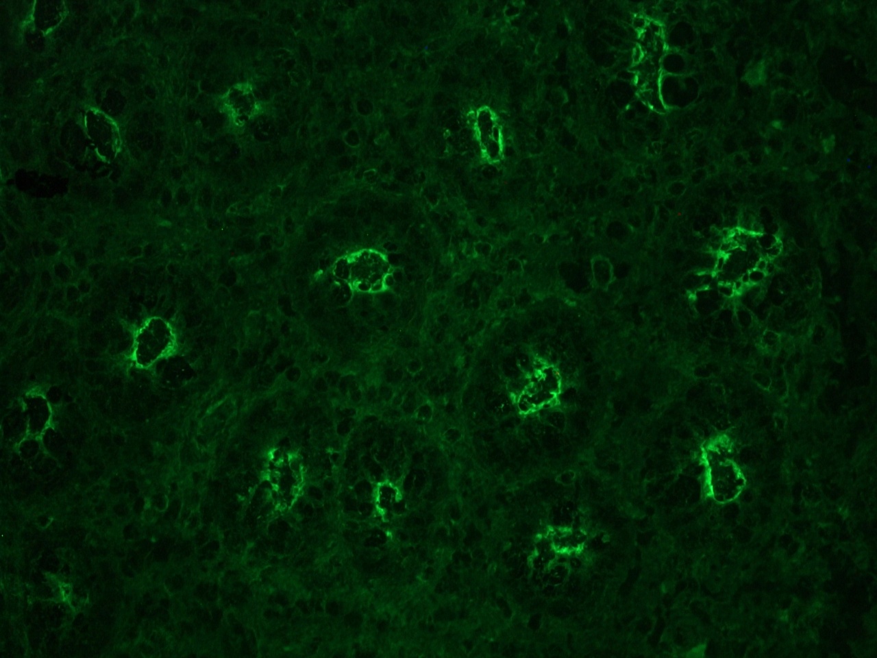 Immunohistochemistry (Formalin/PFA-fixed paraffin-embedded sections) - Anti-gamma Actin antibody [2A3] (AB123034), expandable thumbnail