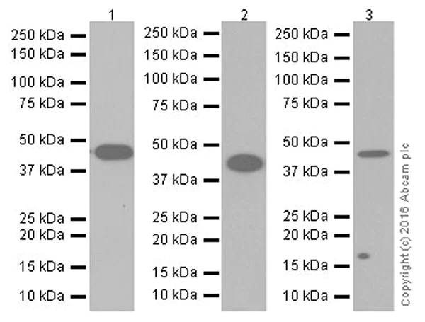 Western blot - Anti-gamma Actin antibody [EPR19353-2] (AB200046)