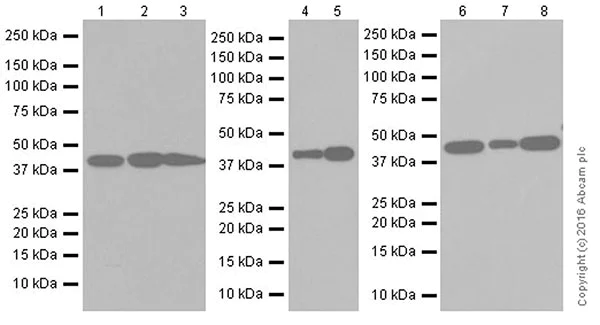 Western blot - Anti-gamma Actin antibody [EPR19353-2] (AB200046)
