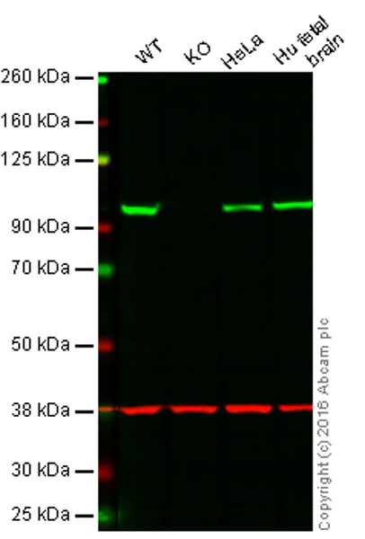 Western blot - Anti-gamma Adaptin antibody [EPR9875(B)] (AB167153)