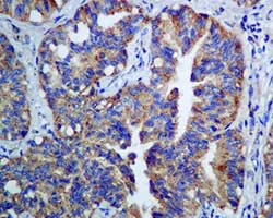 Immunohistochemistry (Formalin/PFA-fixed paraffin-embedded sections) - Anti-gamma Adaptin antibody [EPR9875(B)] - BSA and Azide free (AB249398)