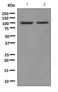 Western blot - Anti-gamma Adaptin antibody [EPR9875(B)] - BSA and Azide free (AB249398)