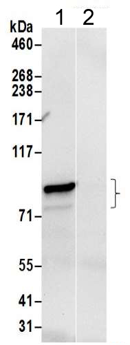 Immunoprecipitation - Anti-gamma Adaptin antibody - N-terminal (AB205953)