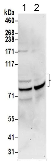 Western blot - Anti-gamma Adaptin antibody - N-terminal (AB205953)