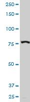 Western blot - Anti-gamma Adducin antibody (AB194426), expandable thumbnail