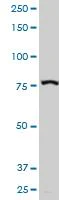 Western blot - Anti-gamma Adducin antibody (AB194426)