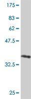 Western blot - Anti-gamma Adducin antibody (AB194426), expandable thumbnail