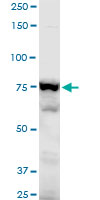 Western blot - Anti-gamma Adducin antibody (AB194426), expandable thumbnail