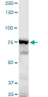 Western blot - Anti-gamma Adducin antibody (AB194426)
