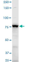 Western blot - Anti-gamma Adducin antibody (AB194426)