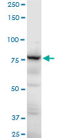 Western blot - Anti-gamma Adducin antibody (AB194426), expandable thumbnail