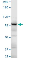 Western blot - Anti-gamma Adducin antibody (AB194426)