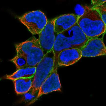 Immunocytochemistry/ Immunofluorescence - Anti-gamma Adducin antibody (AB246992)