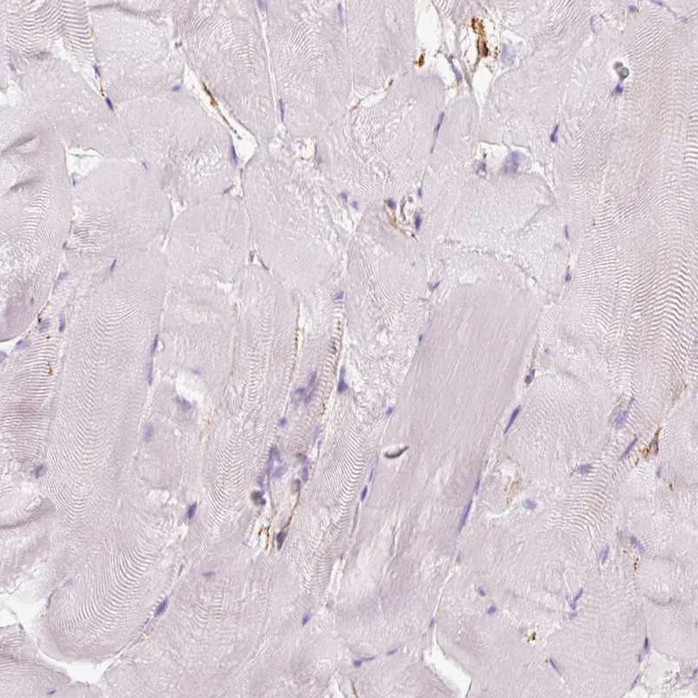 Immunohistochemistry (Formalin/PFA-fixed paraffin-embedded sections) - Anti-gamma Adducin antibody (AB246992)