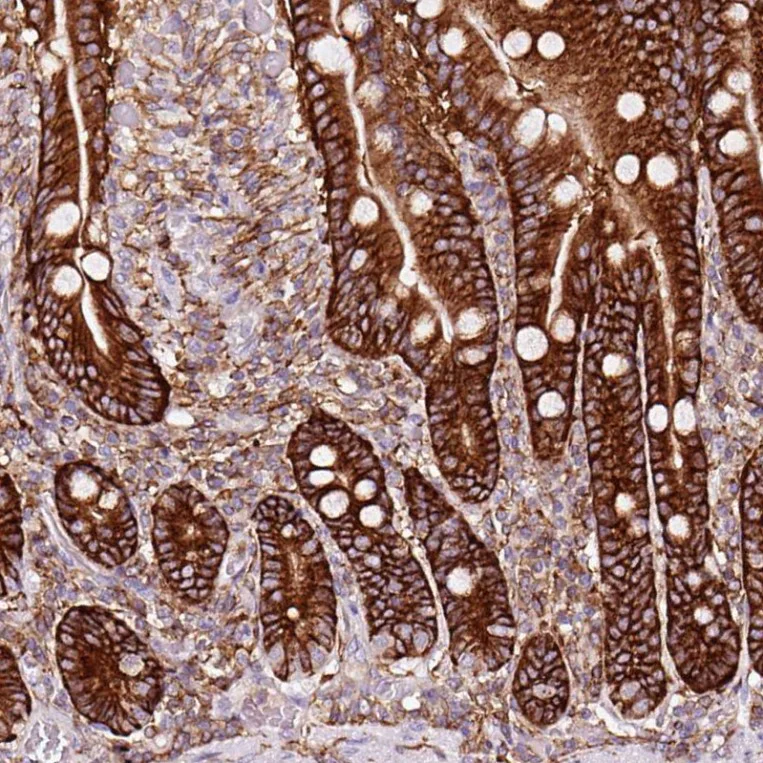 Immunohistochemistry (Formalin/PFA-fixed paraffin-embedded sections) - Anti-gamma Adducin antibody (AB246992)