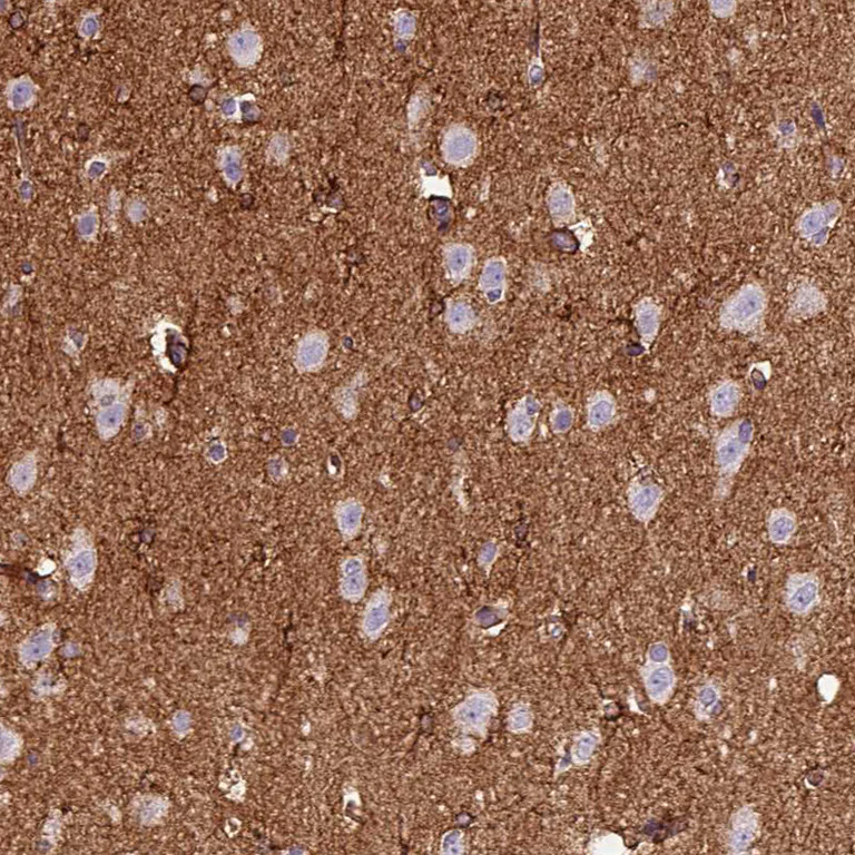 Immunohistochemistry (Formalin/PFA-fixed paraffin-embedded sections) - Anti-gamma Adducin antibody (AB246992)