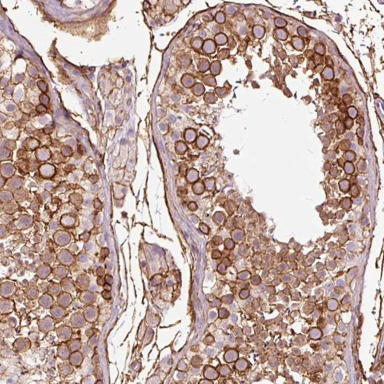 Immunohistochemistry (Formalin/PFA-fixed paraffin-embedded sections) - Anti-gamma Adducin antibody (AB246992)