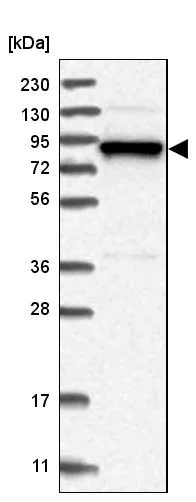 Western blot - Anti-gamma Adducin antibody (AB246992)