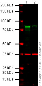 Western blot - Anti-gamma Catenin antibody [11E4] (AB231304), expandable thumbnail