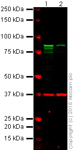 Western blot - Anti-gamma Catenin antibody [11E4] (AB231304)