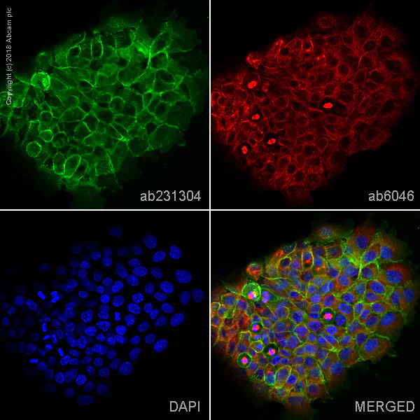 Immunocytochemistry/ Immunofluorescence - Anti-gamma Catenin antibody [11E4] - BSA and Azide free (AB269564)