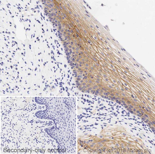 Immunohistochemistry (Formalin/PFA-fixed paraffin-embedded sections) - Anti-gamma Catenin antibody [11E4] - BSA and Azide free (AB269564)