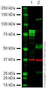 Western blot - Anti-gamma Catenin antibody [11E4] - BSA and Azide free (AB269564)