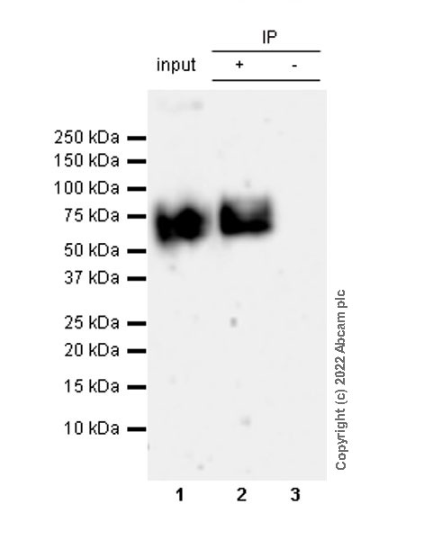 Immunoprecipitation - Anti-gamma Catenin antibody [15/γ-Catenin] (AB305241), expandable thumbnail